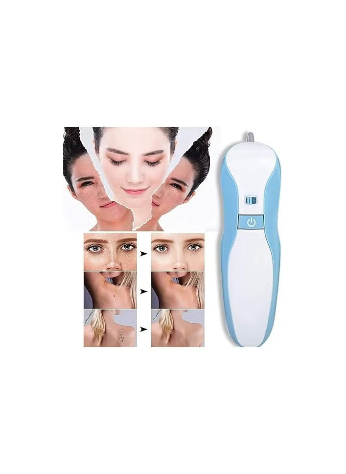 YFD Professional Fibroblast Plasma Pen Mole Removal Pen Skin